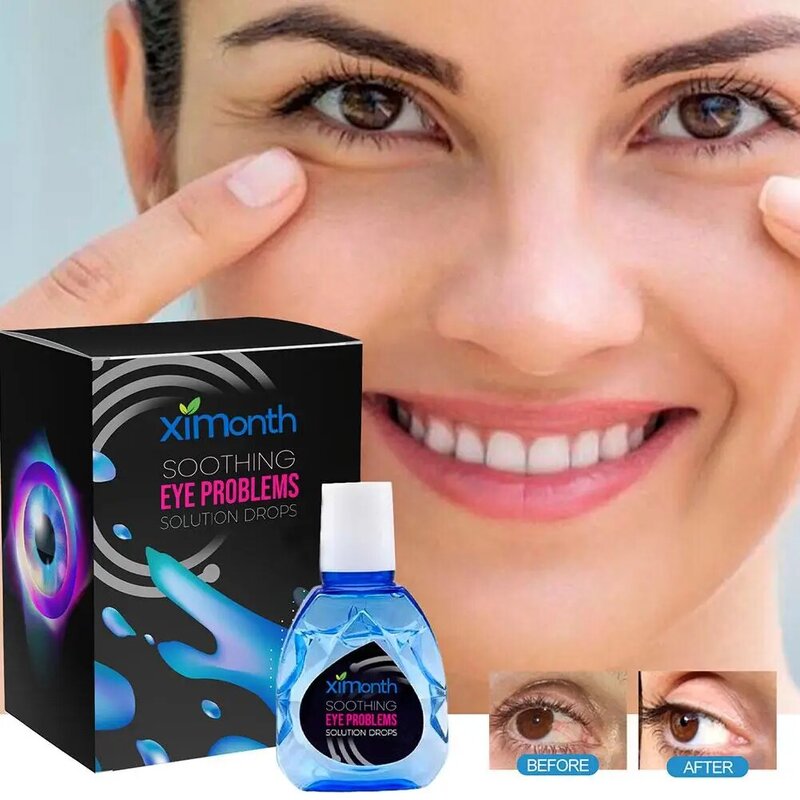 10ml Treatment Eyeproblems Solutiondrops Eye Soothing Drops New Circles Dark Fatigue Improve Reliev Remove Eye Eye Eyesight B2P2