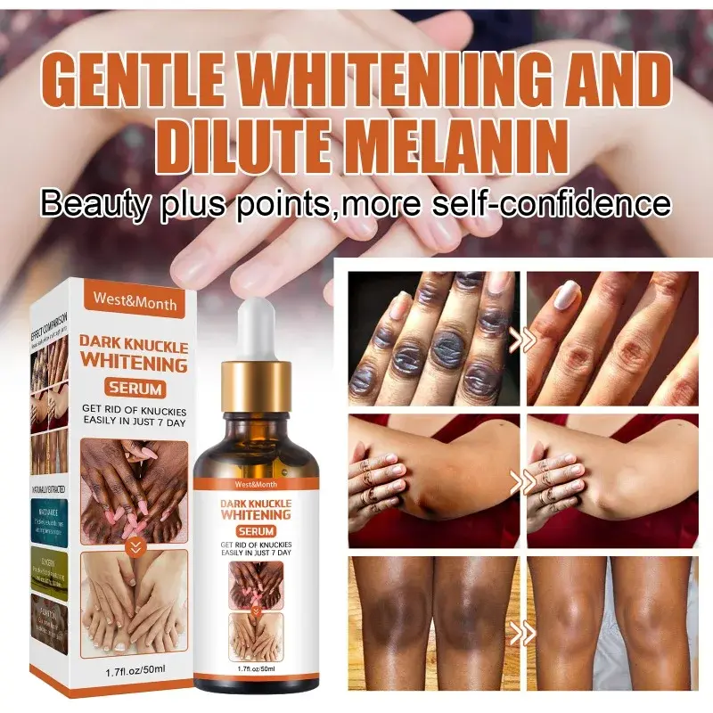 Body Whitening Serum for Dark Skin remove Melanin Dull Knee Ankle Corner Underarm joint Skin Care Private Parts Bleach essence
