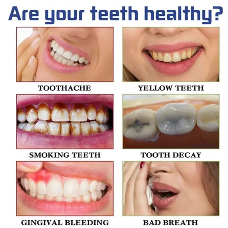 30มล. ใหม่ที่ทำความสะอาดฟัน V34มูสสีม่วงขวดยาสีฟันทำให้สดชื่นขจัดคราบในปากลดอาการเป็นสีเหลืองผลิตภัณฑ์ดูแลช่องปาก