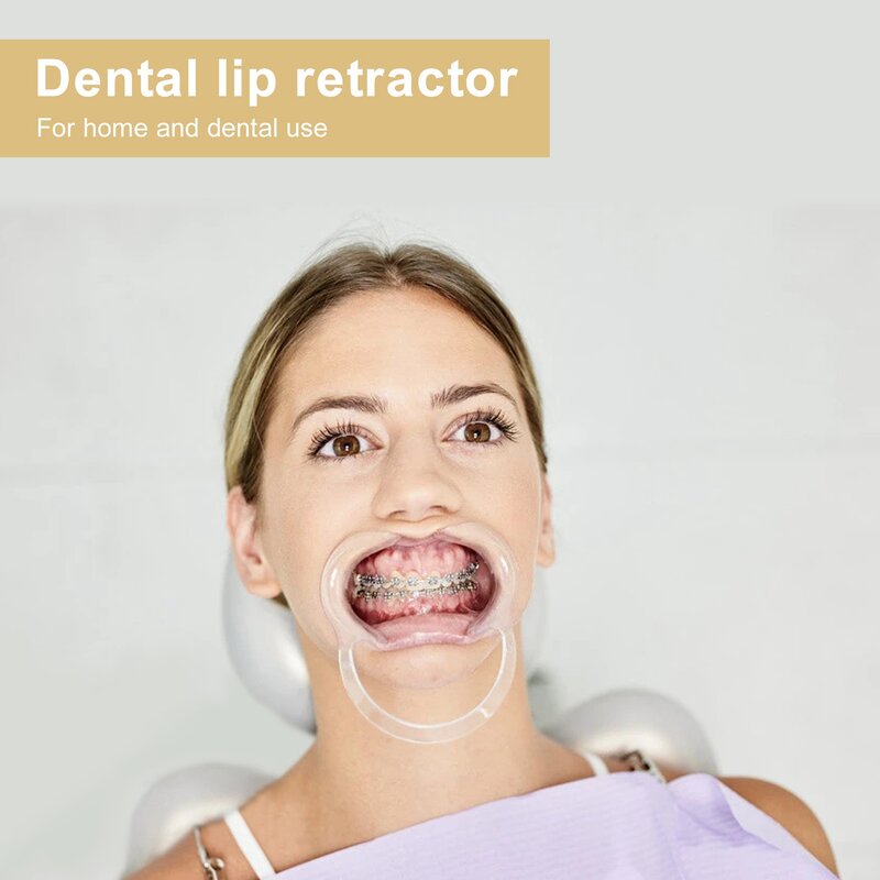 Retractor de labios y mejillas para blanqueamiento Dental, 3 piezas, Autoclavable, uso repetido, S