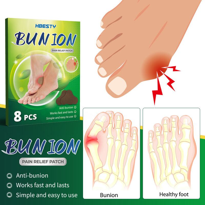 8Pcs Herbal Anti Bunion สติกเกอร์โรคเกาต์ปวด Relief เอว Arthriti Treatment Thumb บวม Toe Joint Valgus Corrector แพทช์