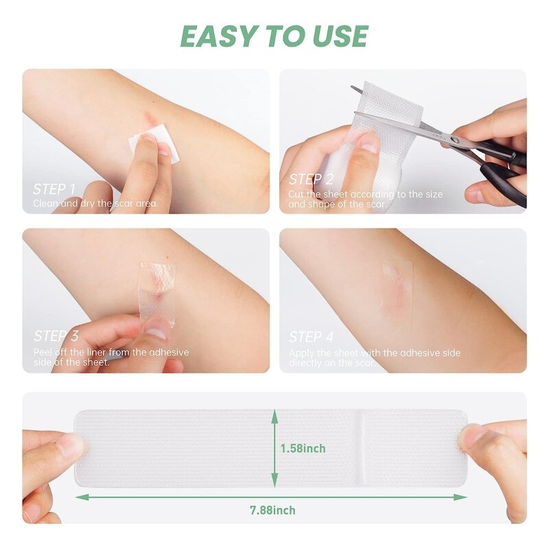 Mebak Silicone Scar Strips Reusable Medical Grade Silicone Scar Treatment Patches For Keloid C-Section Surgical Scars Removal