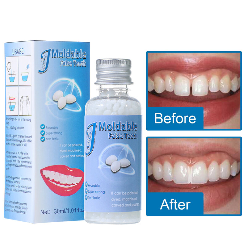 Gigi palsu perekat, 30ml butiran perbaikan gigi Resin alami mengisi sementara celah gigi perbaikan gigi rusak gigi tiruan lem padat