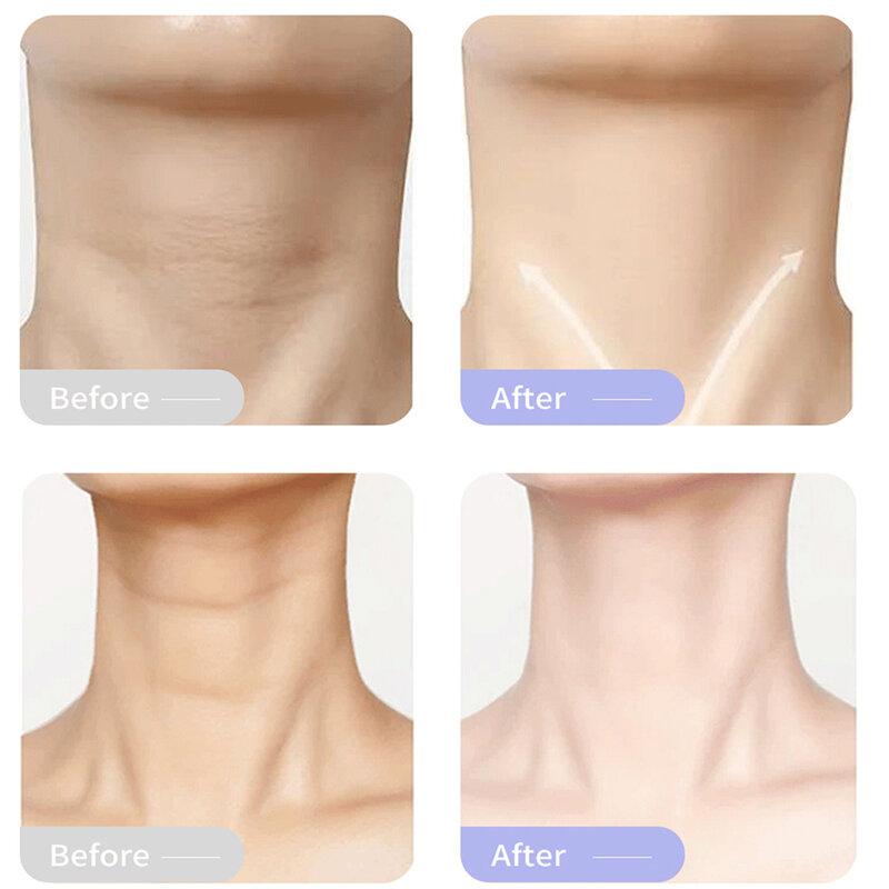 Kolagenowy krem do szyi ujędrniający preparat przeciwzmarszczkowy krem odmładzający ujędrnienie skóry kształt piękno szyi produkty do pielęgnacji skóry