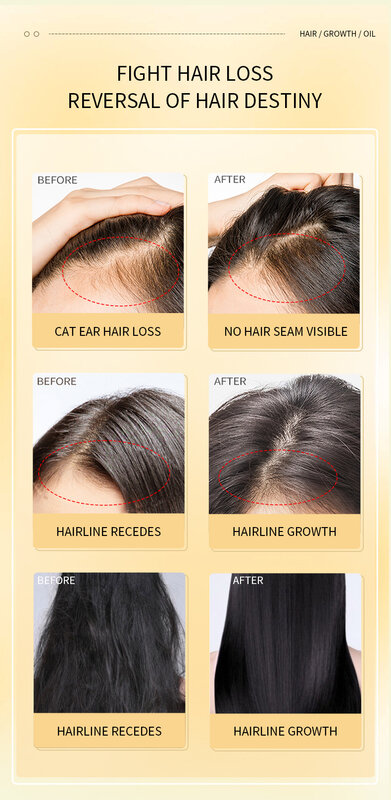 Pielęgnacja skóry głowy płyn przeciw wzrostowi liniejąca sierść do odżywiania włosów esencja płynna do pielęgnacji białe włosy stają się czarne
