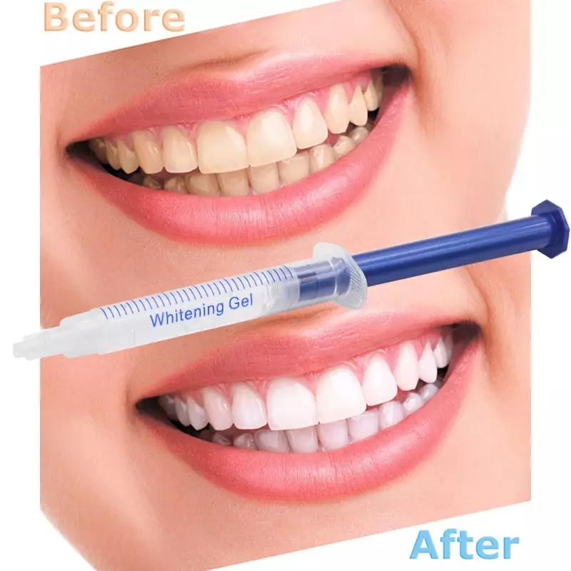 5 Stuks Tanden Whitening Gel Licht Tandheelkundige Apparatuur 44% Peroxide Bleken Clareador Dental Gel Pennen Groothandel Tanden Whitening Kit