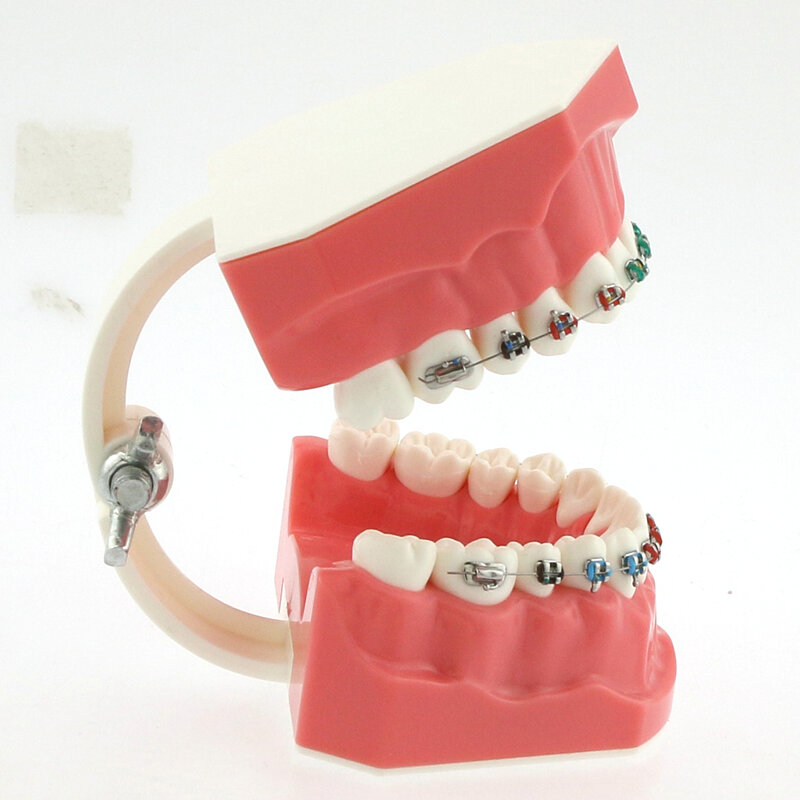 Model gigi 1:1 ortodontik, gigi Typodont dengan penjepit braket logam