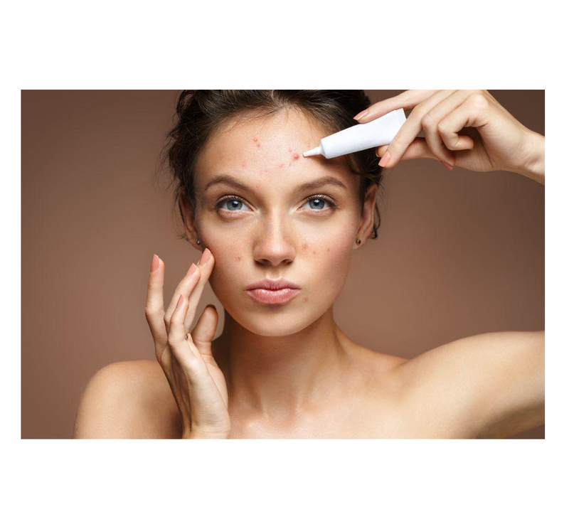 Belleza y cuidado de la salud daño solar cuidado de la piel vitamina A arrugas hidratante acné espinillas removedor de imperfecciones blanqueamiento