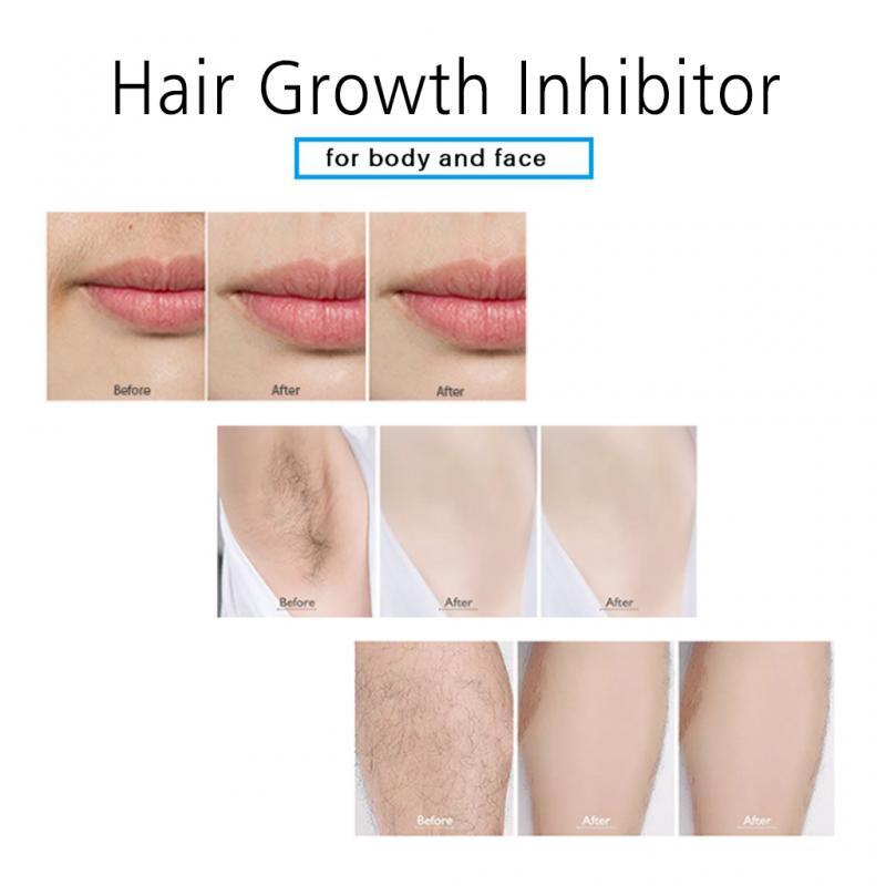 Sprays de crescimento capilar, impede o crescimento do cabelo, hidratação suave, não irrita, creme de remoção de pelos