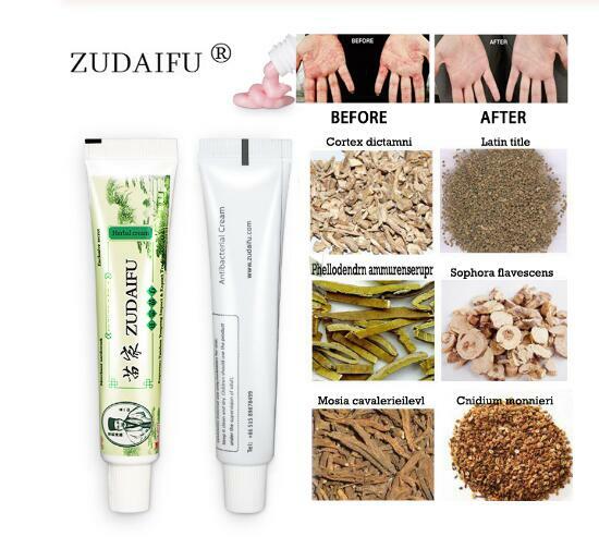 Zudaifu-Crema para Psoriasis de la piel, ungüento para el tratamiento de la Psoriasis, Dermatitis, Eczematoid, 10 Uds.