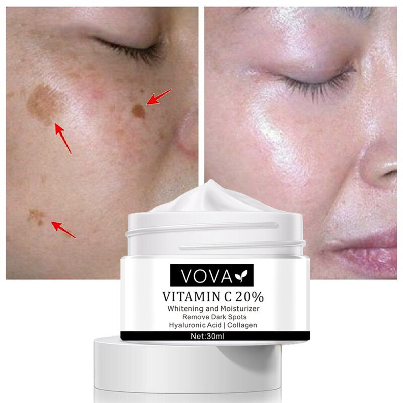 20% witamina C krem wybielający rozjaśnić ciemne plamy znikną skazy Anti-Aging piegi blizny potrądzikowe wybielanie melaniny Remover pielęgnacja skóry