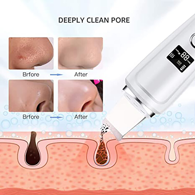 Skin Scrubber Face Spatula Blackhead Remover Ultrasonic Pore Cleaner with 3 modes Comedones Extractor for Facial Tool