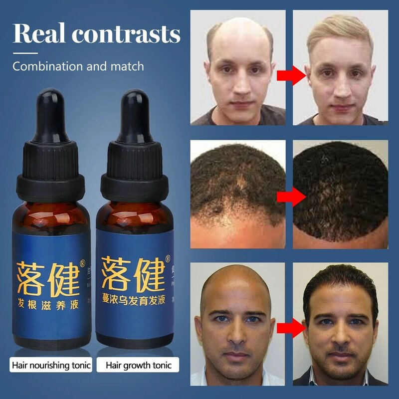 Aceite esencial para el crecimiento del cabello, tratamiento para el crecimiento del cabello, producto anticaída, productos naturales Herbal nutritivos para el cuidado del cabello, suero para el cabello