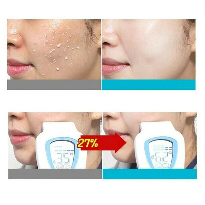Mulheres acne poros minimizadores esfoliador facial peeling gel suave 100g hidratante hjl2019
