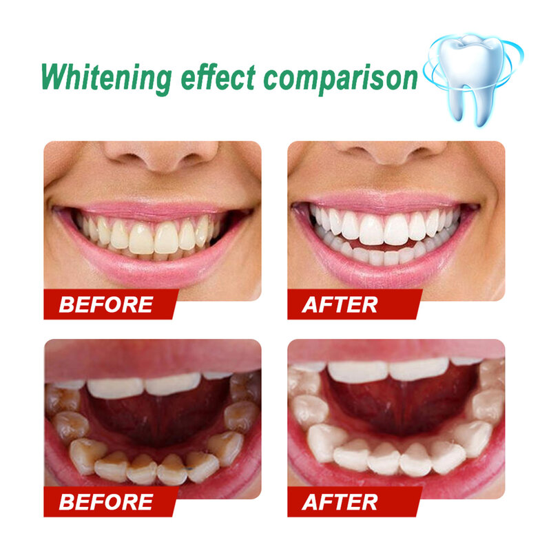 Dentes branqueamento essência em pó branco dentes limpeza pasta de dentes remover manchas de placa respiração fresca higiene oral dental cuidados com os dentes