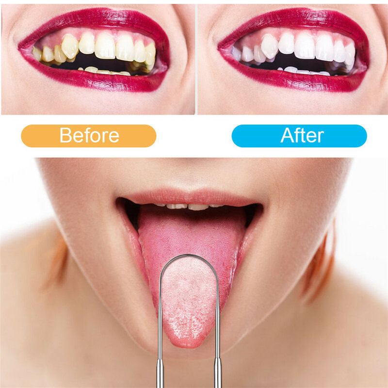 Elektrische Sonic Oral Irrigator Dental Scaler Zahn Zahnstein Munddusche USB Aufladbare Zähne Gesundheit Hygiene Dental Scaler