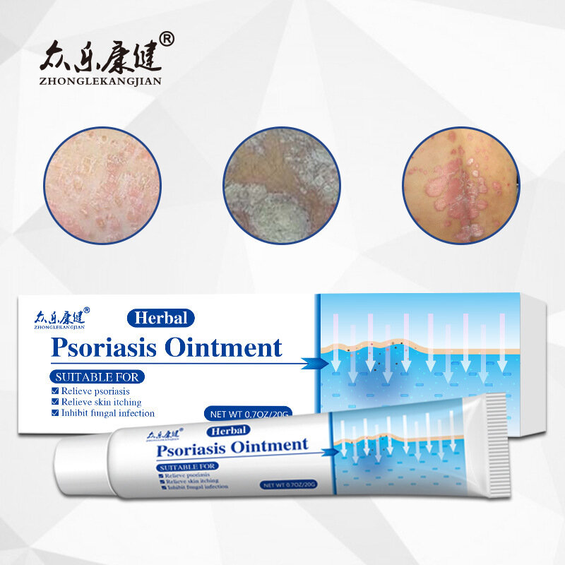 Pomada antibacteriana para Psoriasis, tratamiento de descamación para el cuidado de la piel, Eczema, Rash, Urticaria, 20g