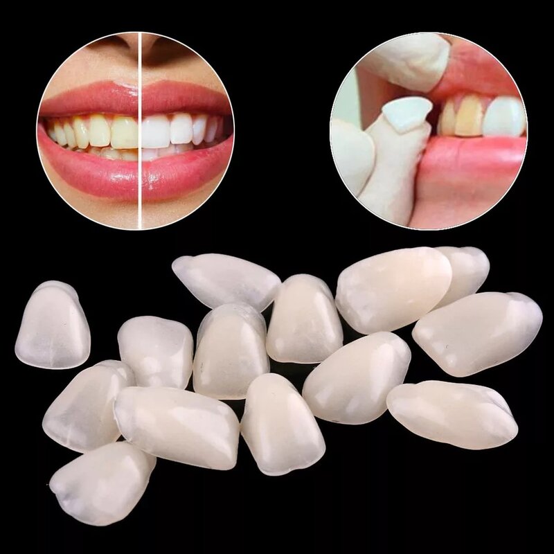 3ml dentale denti bianchi Gel Comfort Bond impiallacciatura di denti adesivo rapido desensibili formula equivalente sbiancamento dei denti prodotti