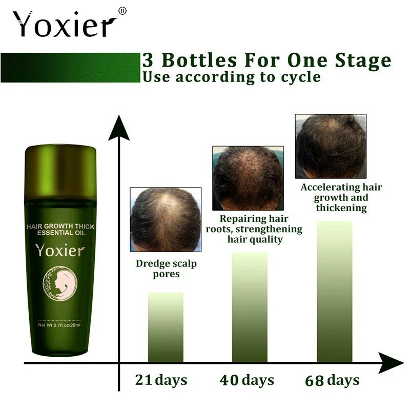 Crescimento do cabelo de ervas óleo essencial promover o crescimento ativar folículos de cabelo nutrição profunda impedir a perda de cabelo reparação de controle de óleo