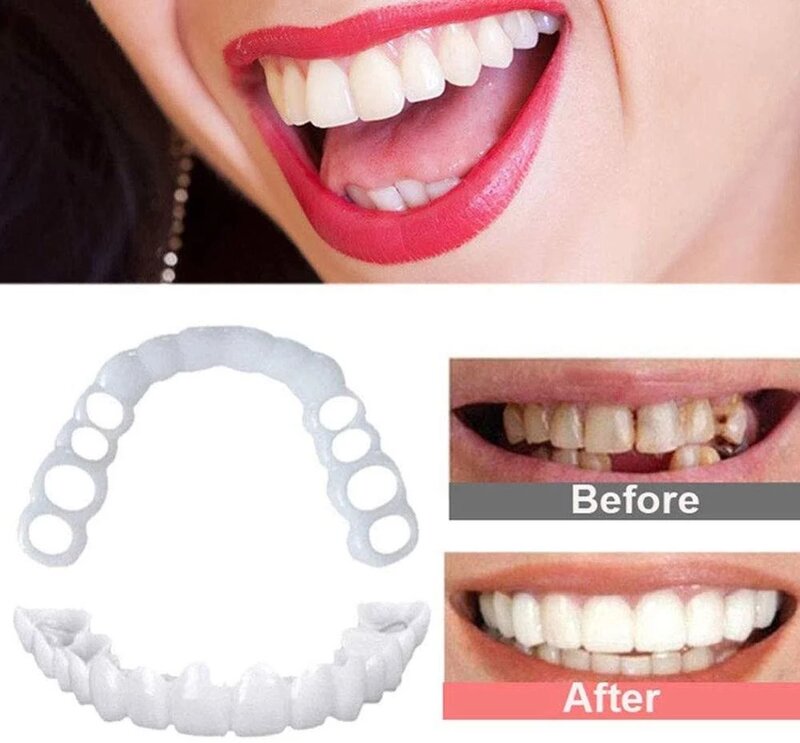 Dentadura de silicone chaves superior e inferior dentes falsos dental clareamento sorriso folheados dentista ferramentas cosméticas falso capa de dente ii