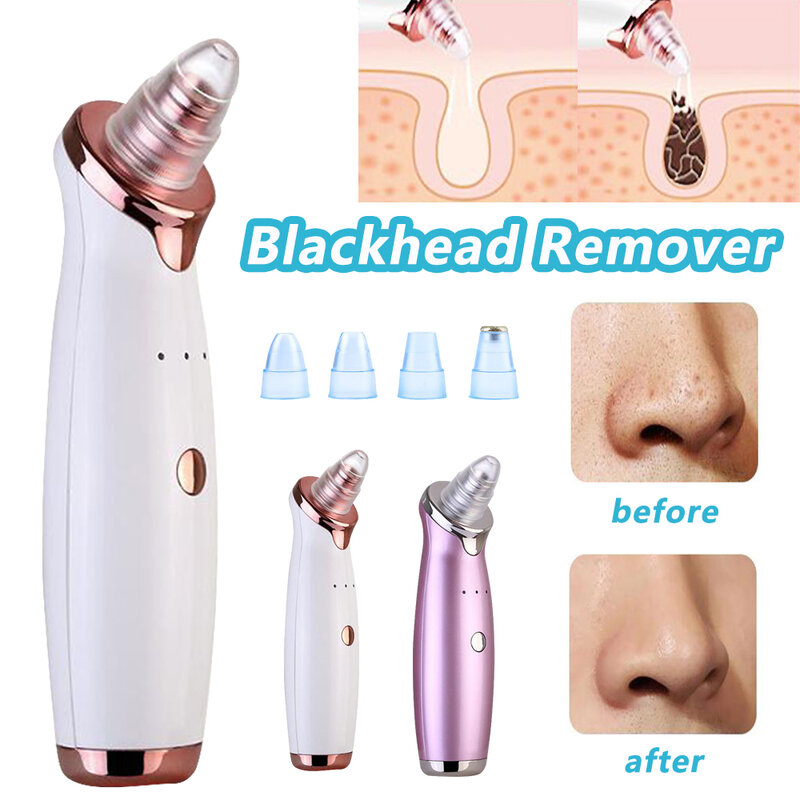 Face Facial Pore Blackhead Remover Vacuum Derma Suction Diamond Dermabrasion