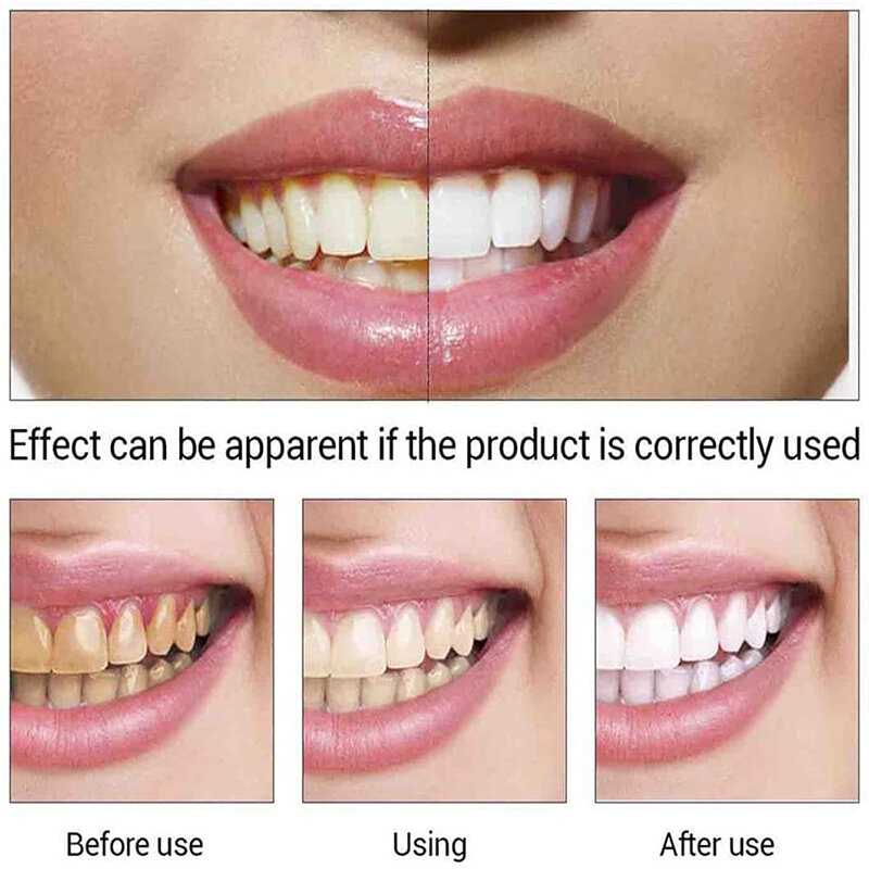 Placa dental limpo cuidado oral líquido reparação preto amarelo dentes respiração fresca higiene oral ferramentas odontológicas higiene oral limpeza