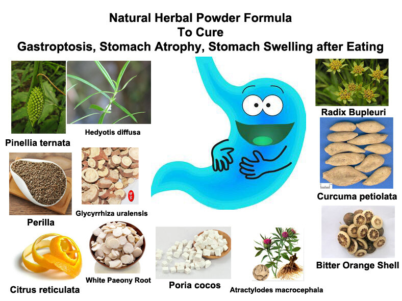 Formula Bubuk Herbal Alami Hurbolisme untuk Menyembuhkan Sakit Perut Tukak Lambung, Atrofi Perut, Pembengkakan Perut Setelah Makan