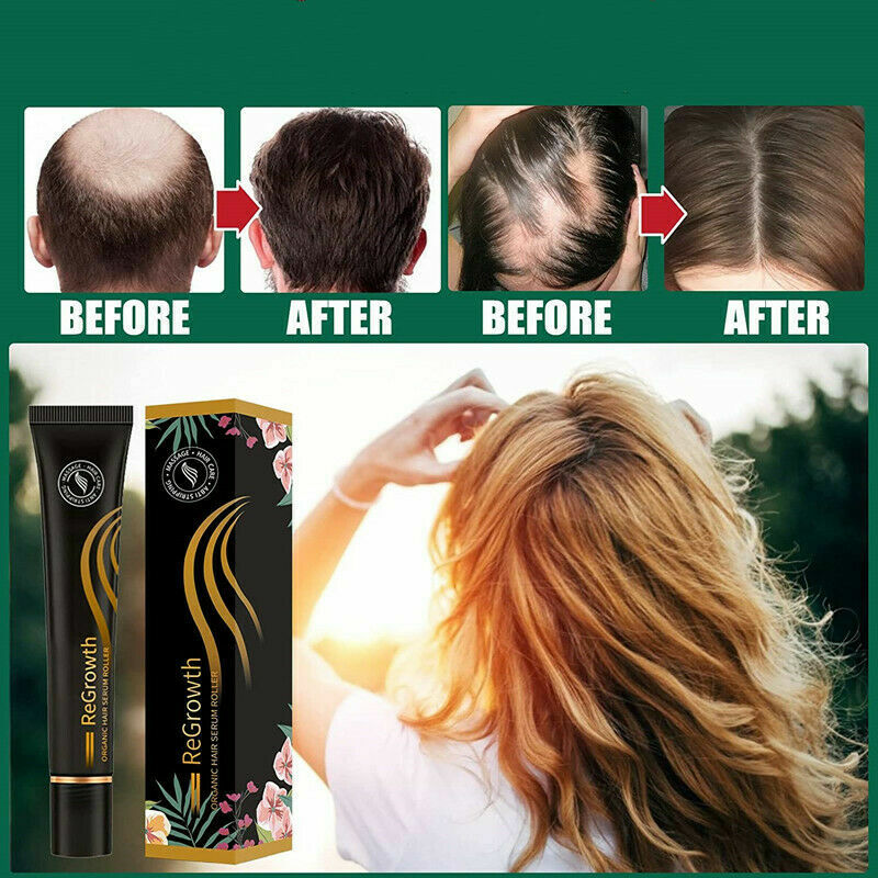 Organic Hair Serum Roller Set Hair Care Anti Stripping Liquid Rolling Ball Massage Antidropping Liquid Improve Hair Loss Essence