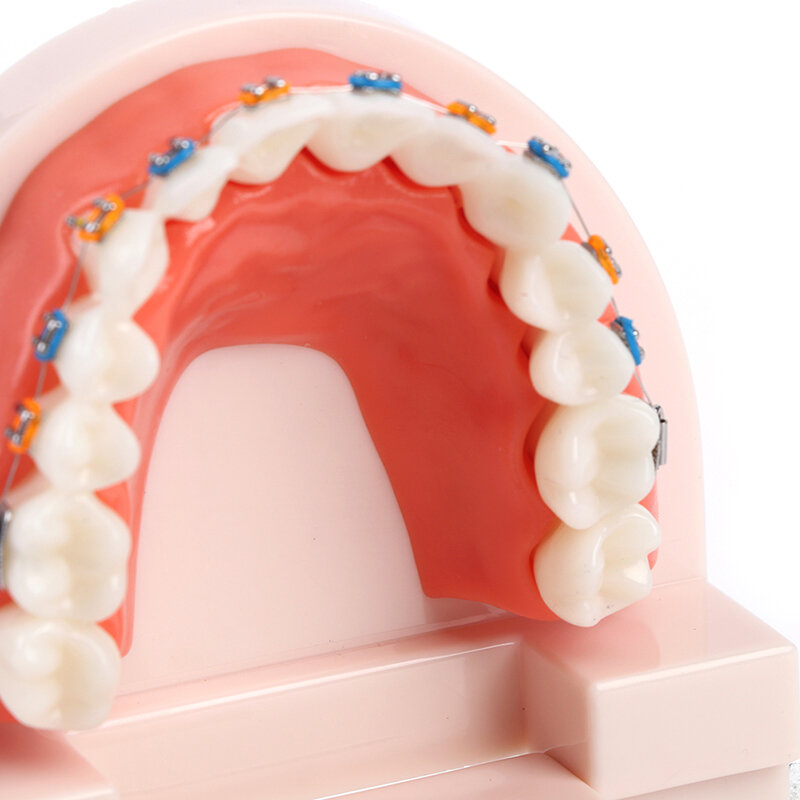 Tandheelkundige ortodoncja Tanden Model z metalami Beugels Bretels School Onderwijs Apparatuur