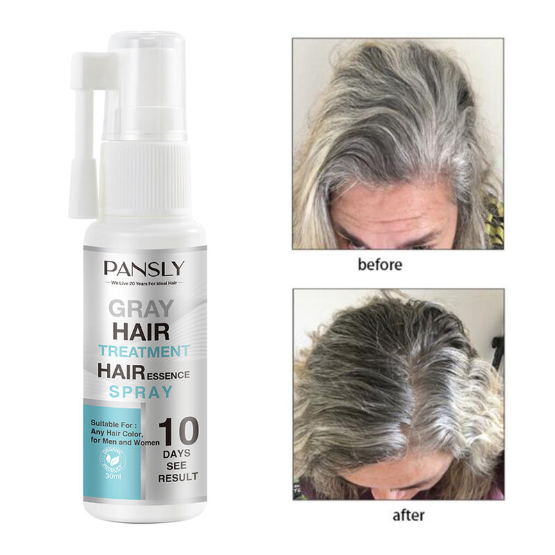 علاج عشبي سحري للشعر الأبيض لإصلاح الشعر بالرش للرجال والنساء