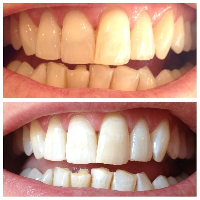 有機ハーブエキス歯のホワイトニング健康口腔衛生クリーニング口腔ケアクリーン余分なクールな歯ペースト削除染色プラーク