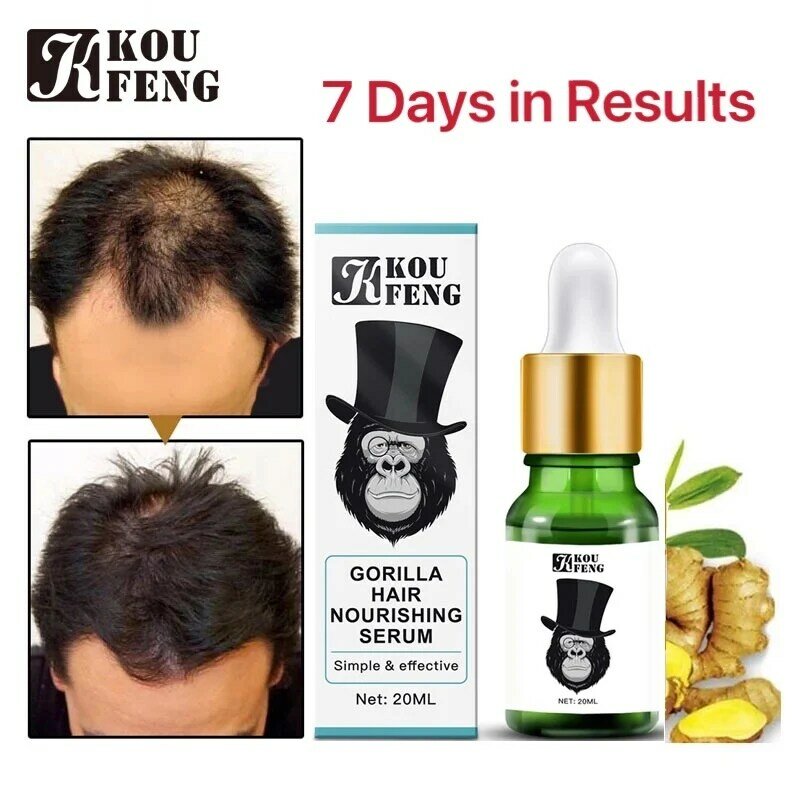Aceite esencial para el cuidado del cabello para hombres y mujeres, aceite esencial para el crecimiento del cabello, antivaho, tratamiento de regeneración, adecuado para todos los tipos de cabello