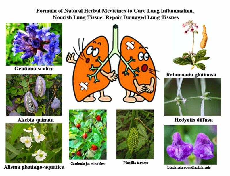Formula of Natural Herbal Medicines to Cure Pneumonia Lung Inflammation, Nourish Lung Tissue, Repair Damaged Lung Tissues 