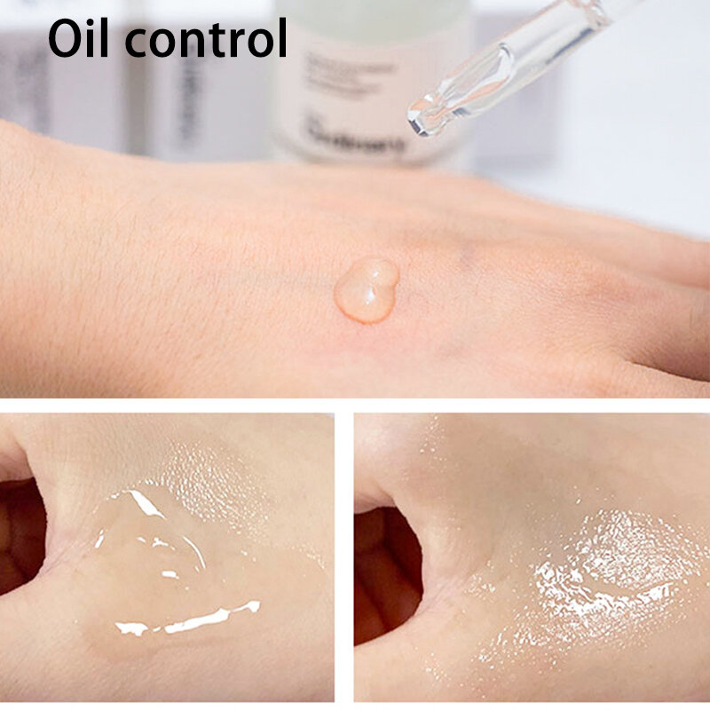 Niacinamida comum 10% + zinco 1% essência mineral alta hidratação desvanece-se manchas de acne regula sebo minimiza os poros cuidados com a pele