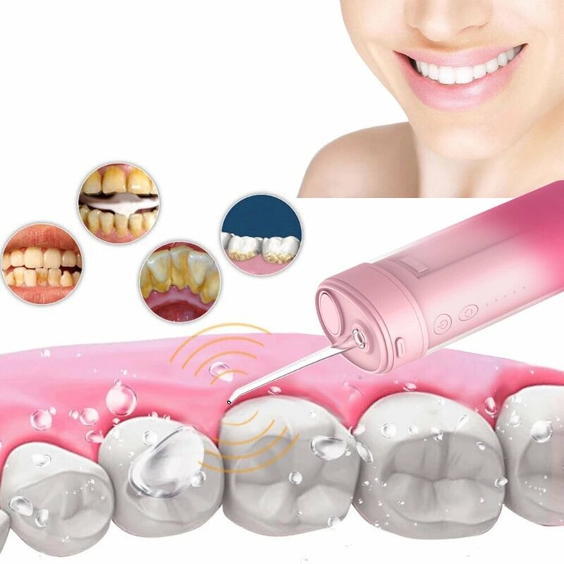 Limpiador de dientes Oral eléctrico, escarificador para eliminar manchas de sarro, irrigador Dental, chorro de agua, cuidado de los dientes