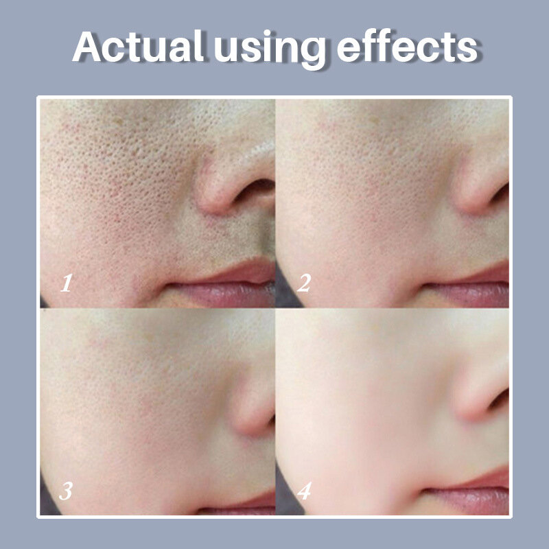 Lanbena soro de encolher poros grandes, tratamento aliviar a secagem do óleo controle clareamento hidratante anti-envelhecimento cuidados da pele