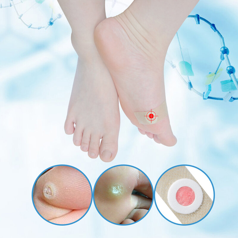 Foot Corn Removal Removing Prickles And Calluses Plantar Warts Thorn Pain Relief Curative Medical Sticker Curative Plaster