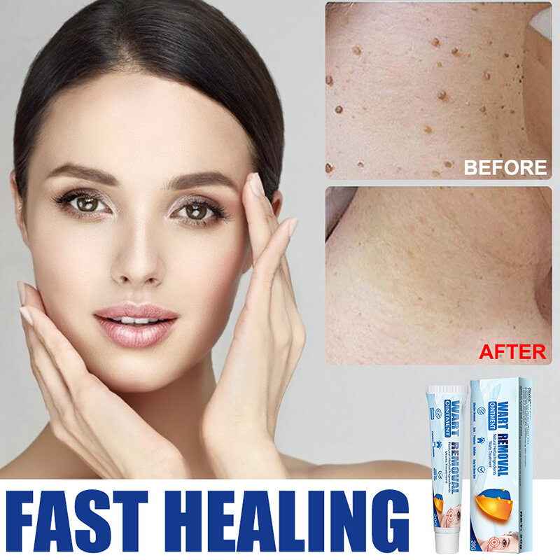 Tratamento da remoção da etiqueta da pele do creme do removedor da verruga com fonte natural do corpo dos ingredientes health99