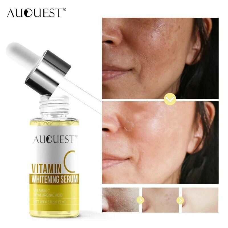 Vitamin C Bleaching Gesicht Serum Erleichtern Dunkle Flecken Aufhellung Entfernen Sommersprossen Speckle Akne Narben Esence Reparatur Hautpflege Produkte