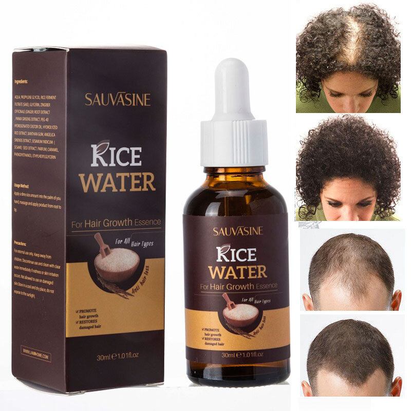 Productos para el cabello de agua de arroz para hombre y mujer, crecimiento del cabello que promueve el crecimiento del cabello, reparación rápida del cabello dañado, nutre las raíces del cabello, Anti pérdida de cabello