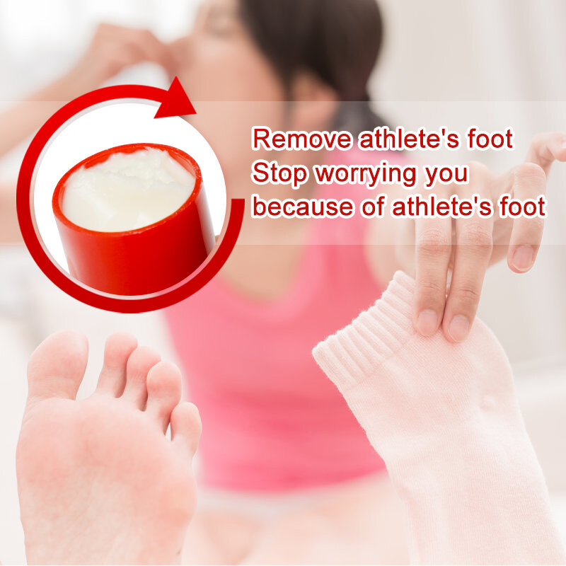 Pomada para los pies para atletas, 5 uds., tratamiento antipicaduras e infecciones de hongos, alivia la picazón, reparador de pies D3691