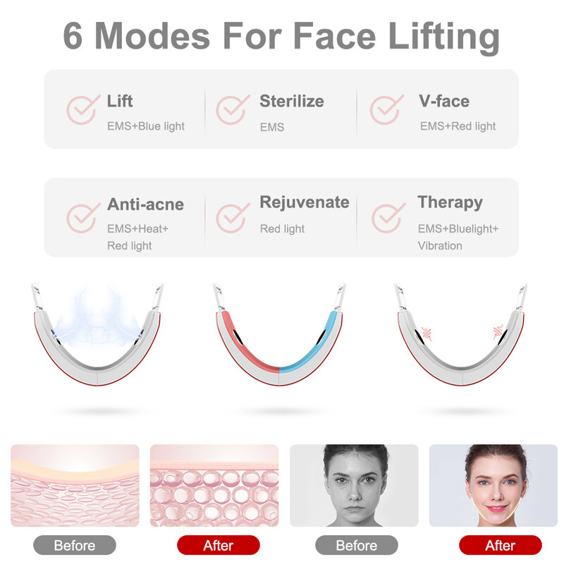 AmazeFan EMS Gesichts Hebe Gerät Doppel Kinn Entfernen Kinn Gesicht Straffende LED Photon Therapie Wange Fahrstuhl Up Gürtel Schönheit Gerät