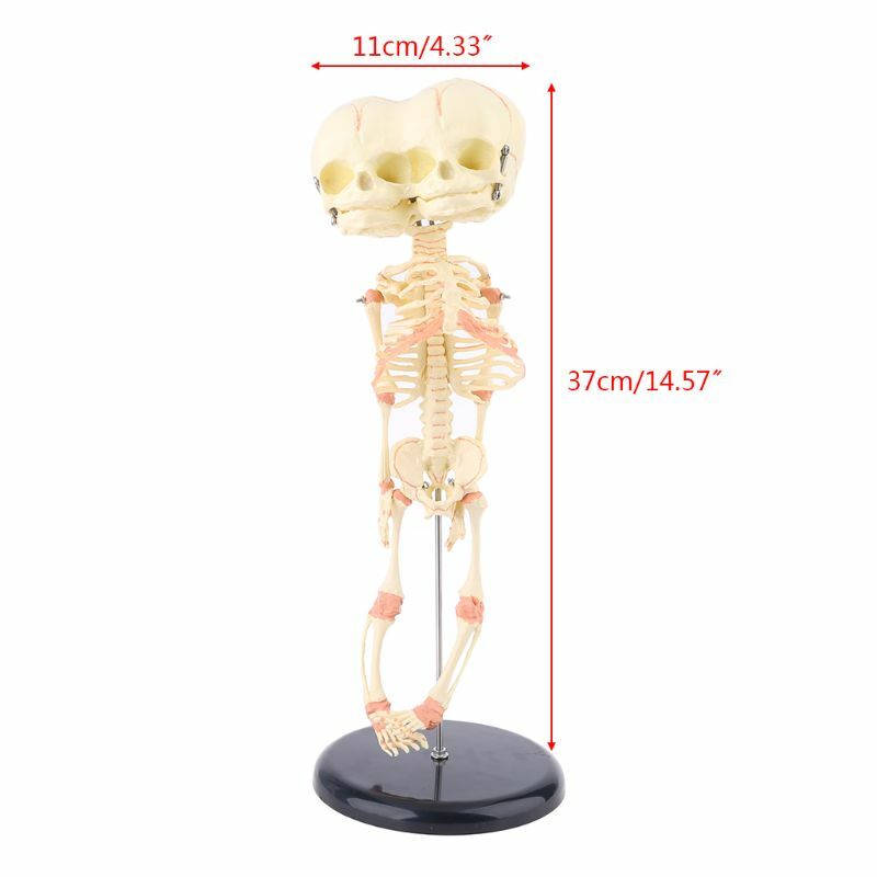 Cabeza deformada de bebé humano, modelo de investigación de cráneo, esqueleto, cerebro anatómico, exhibición de enseñanza de anatomía