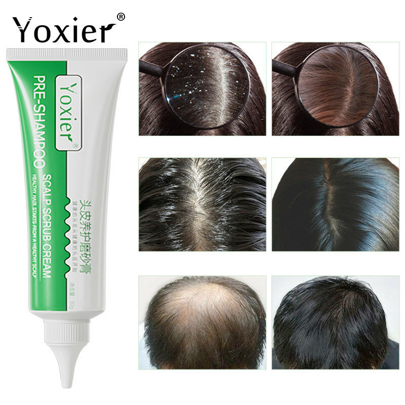 Yoxier crescimento do cabelo pré-shampoo couro cabeludo esfrega controle de óleo reparação antiprurtic limpeza profunda suave esfoliante creme tratamento dandruf 60g