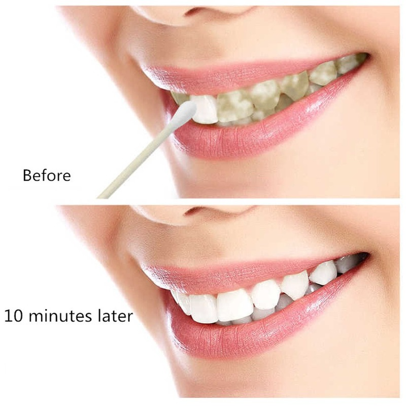 ฟันไวท์เทนนิ่งลบฟันคราบสดใสสีเหลืองฟอกสีฟันน้ำมัน Oral สุขอนามัยฟันขาวฟันขาว