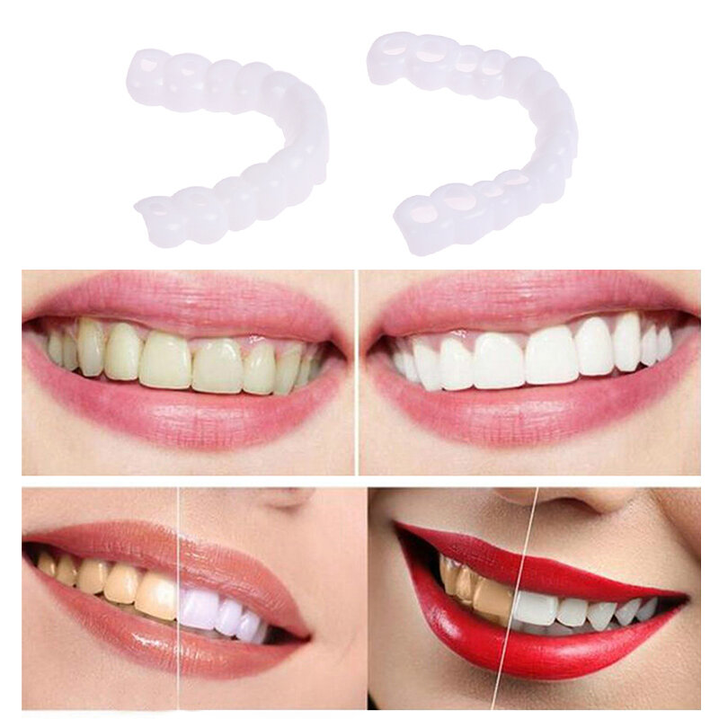 HNKMP Veneer Senyum Sempurna Palsu Atas dan Bawah Nyaman Flex Gigi Pasta Gigi Palsu Alat Kawat Gigi Pemutih