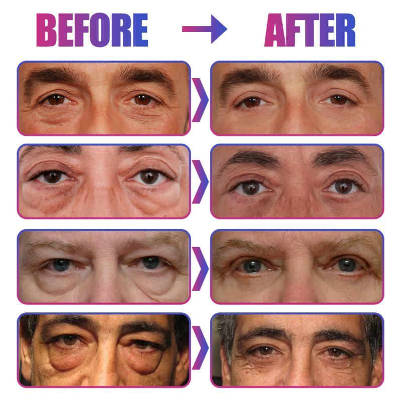 Men's Eyes Cream Dark Circles Remover Eye Bags Cream Under The Eyes Of Tight Anti Aging Cream Skin Care Day And Night TXTB1