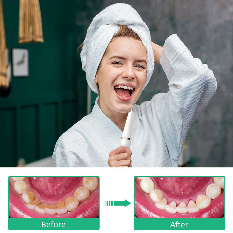 Dental removedor de cálculo tártaro removedor elétrico ultra-sônico clareamento dos dentes mais limpo dente mancha remoção casa dental scaler