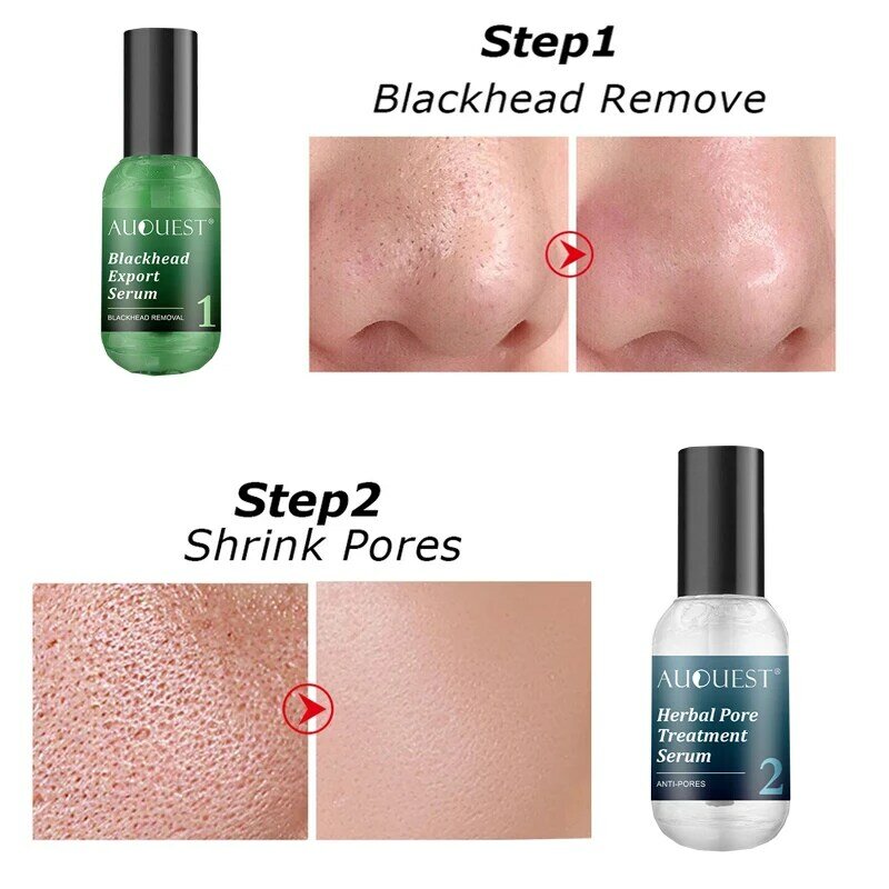 AUQUEST – sérum anti-points noirs pour le visage, blanchissant, resserre les Pores, contrôle du sébum, ensembles de soins pour la peau