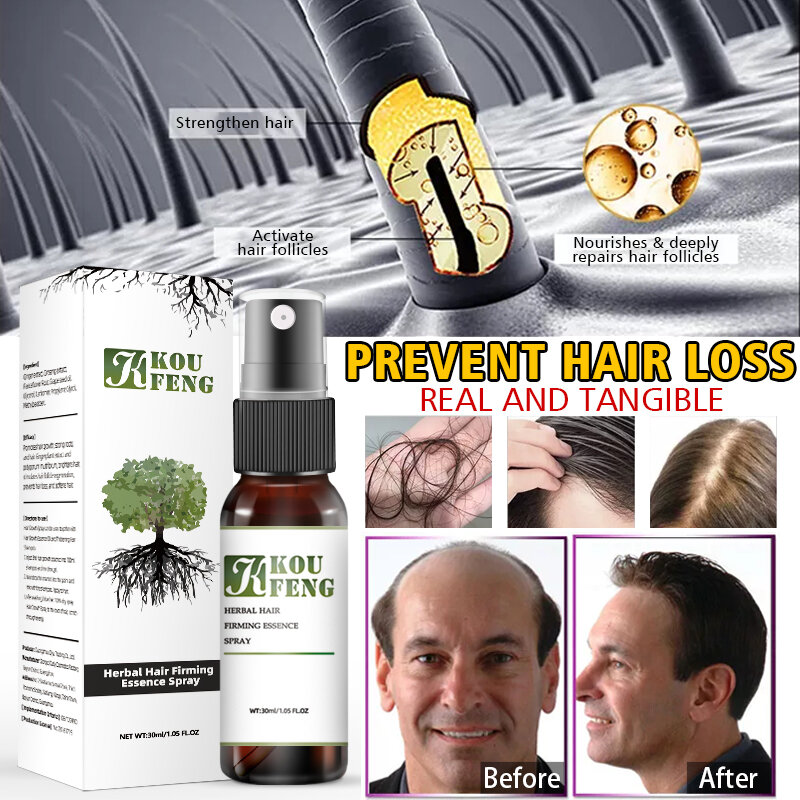 Tratamento da perda de cabelo do pulverizador da essência do crescimento do cabelo de 30ml koufeng anti-perda de cabelo